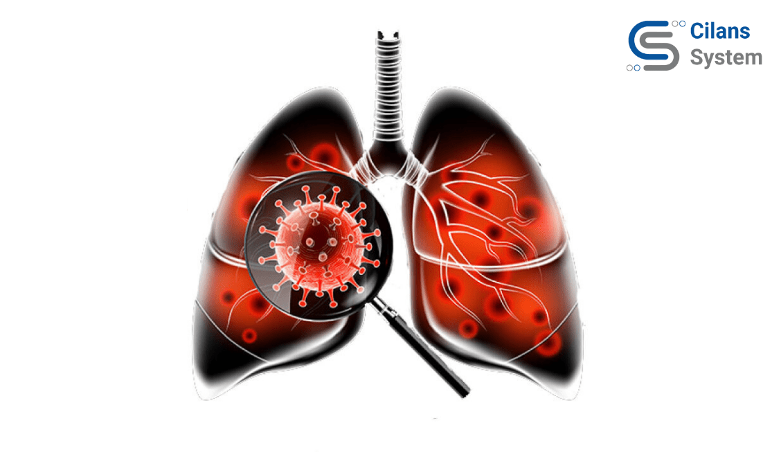 COVID detection from chest X-Ray/CT Scan